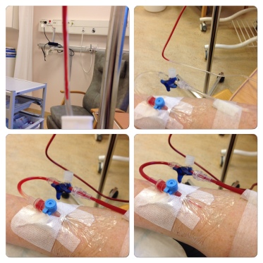 2015-02-05: Blood transfusion